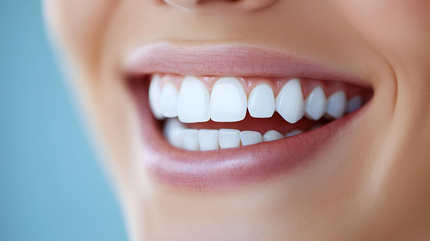 Teeth Whitening